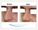 Slider image (5) Aesthetic Cosmetic Plastic Surgery Center Bolivia - SensualBodyDream
